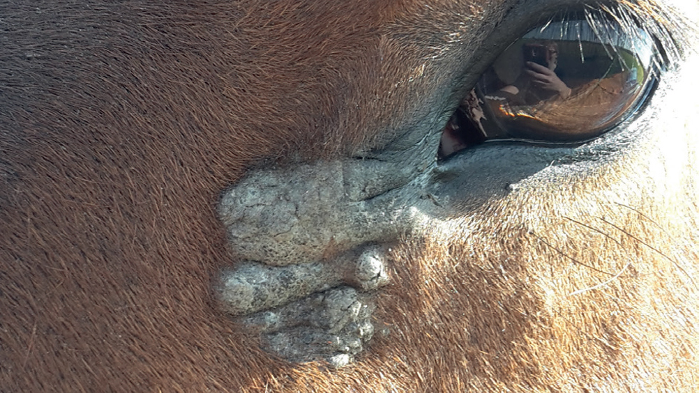 Figure 2. Verrucose sarcoid lesion at the medial canthus.